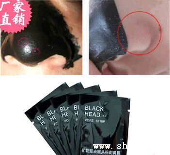 科学祛除粉刺黑头 解析鼻贴与矿物泥的神奇效果